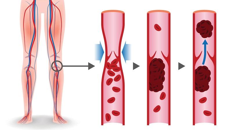1739352535.142377 166456 image بهترین دکتر نارسایی شریانی در رشت + لیست 10 تایی