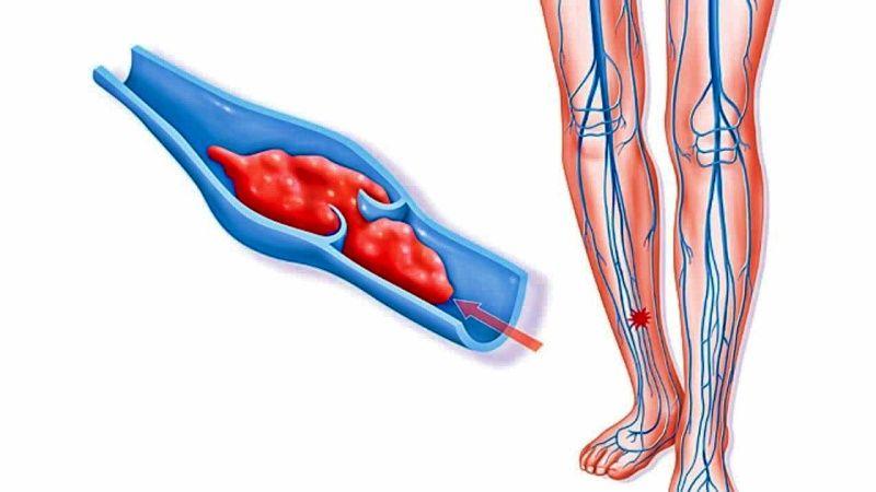 1739352535.152805 399475 image بهترین دکتر نارسایی شریانی در رشت + لیست 10 تایی