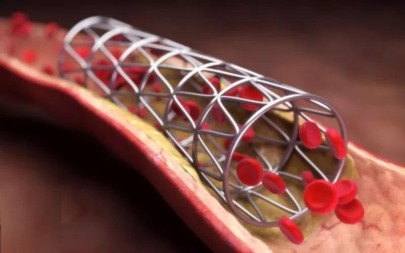 1739352552.062228 228767 image بهترین دکتر فنر قلب در کرمان + لیست 10 تایی