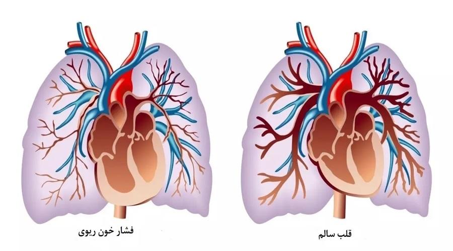 1739352585.729228 888154 image بهترین دکتر فشار خون ریوی در مشهد + لیست 10 تایی